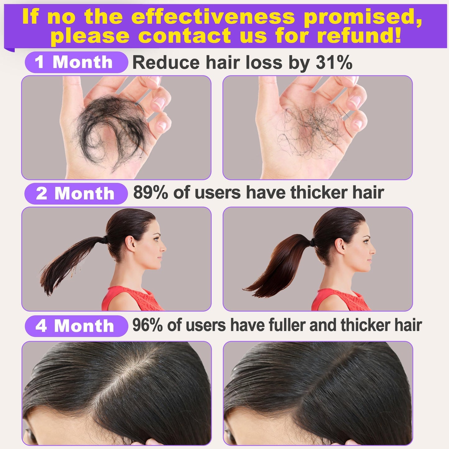 Rosemary Oil for Hair Growth,Diluted Rosemary Oil with Sclap Massager&Ebook,Hair Growth Oil Serum with Castor Oil Biotin Argan for Dry Damaged Hair,Hair Ingrown Loss Treatments for Women Men