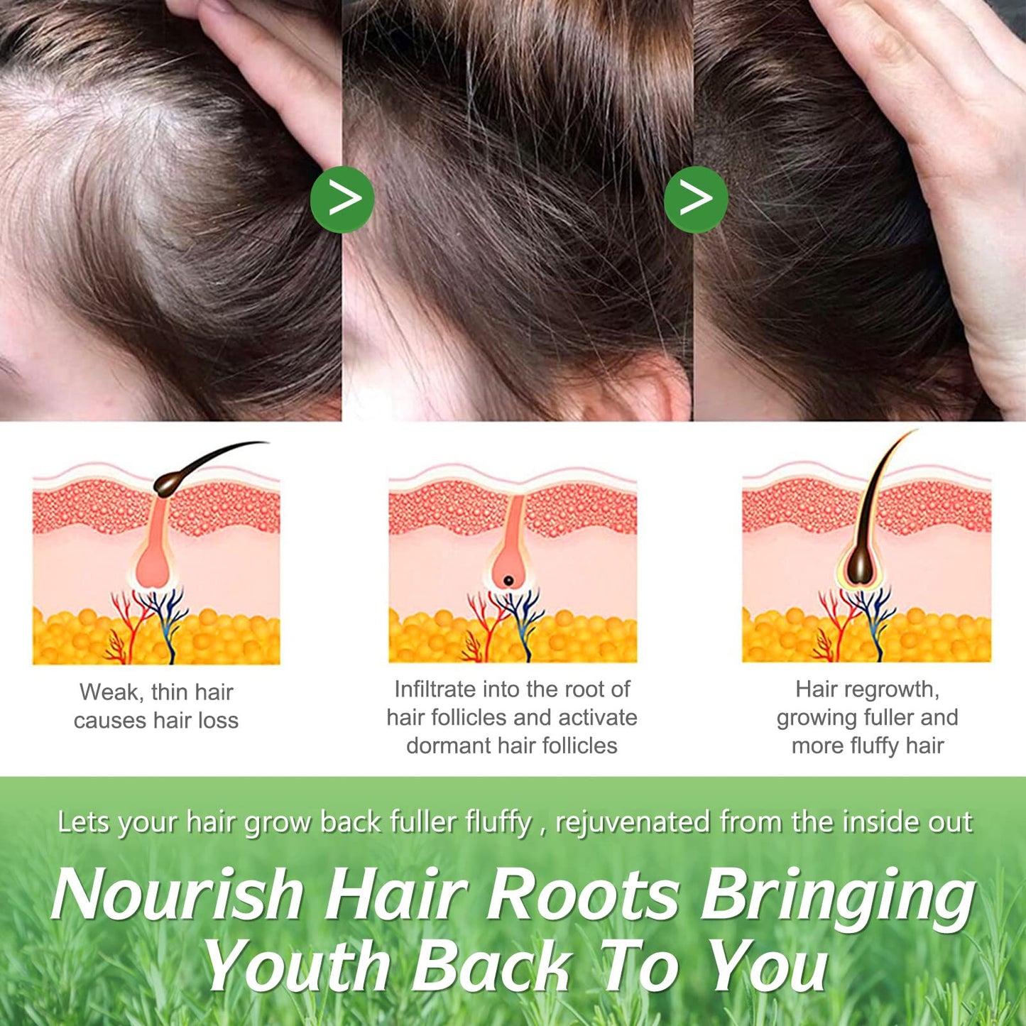 ELBBUB Rosemary Oil for Hair Growth - Undiluted Rosemary Oil for Hair Skin - Cleansing Rosemary Essential Oil for Dry Scalp Care Rid of Itchy and Dry Scalp, 1, 120.0 millilitre